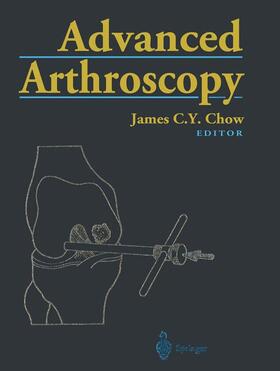 Chow |  Advanced Arthroscopy | Buch |  Sack Fachmedien