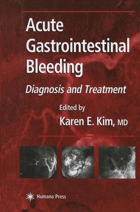 Kim |  Acute Gastrointestinal Bleeding | Buch |  Sack Fachmedien