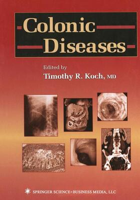 Koch |  Colonic Diseases | Buch |  Sack Fachmedien