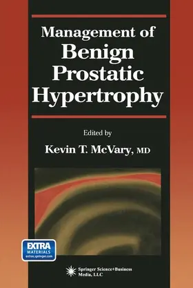 McVary |  Management of Benign Prostatic Hypertrophy | Buch |  Sack Fachmedien