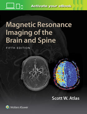 Atlas |  Atlas, S: Magnetic Resonance Imaging of the Brain and Spine | Buch |  Sack Fachmedien