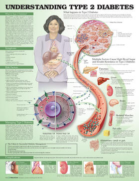 Anatomical Chart Company / Unger |  Understanding Type 2 Diabetes Anatomical Chart | Sonstiges |  Sack Fachmedien