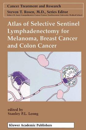 Leong |  Atlas of Selective Sentinel Lymphadenectomy for Melanoma, Breast Cancer and Colon Cancer | Buch |  Sack Fachmedien