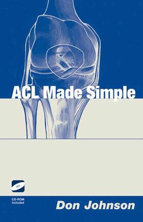 Johnson |  ACL Made Simple | Buch |  Sack Fachmedien