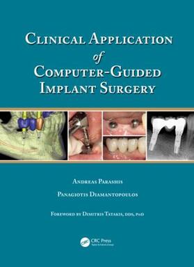 Parashis / Diamantopoulos |  Clinical Application of Computer-Guided Implant Surgery | Buch |  Sack Fachmedien