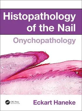 Haneke |  Histopathology of the Nail | Buch |  Sack Fachmedien