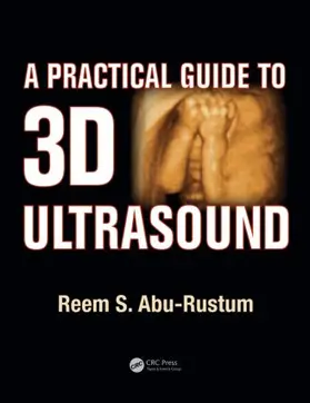 Abu-Rustum |  A Practical Guide to 3D Ultrasound | Buch |  Sack Fachmedien