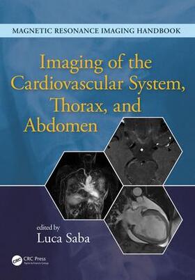 Saba |  Imaging of the Cardiovascular System, Thorax, and Abdomen | Buch |  Sack Fachmedien