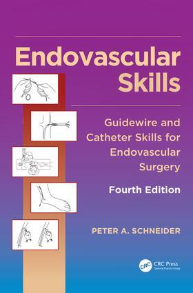 Schneider |  Endovascular Skills | Buch |  Sack Fachmedien
