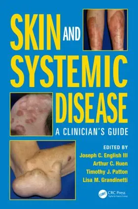 English III / Patton / Huen |  Skin and Systemic Disease | Buch |  Sack Fachmedien