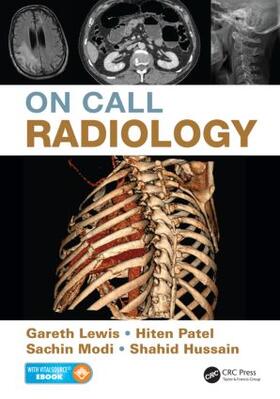 Lewis / Modi / Patel |  On Call Radiology | Buch |  Sack Fachmedien