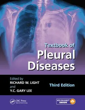 Light / Lee |  Textbook of Pleural Diseases | Buch |  Sack Fachmedien