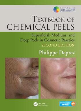 Deprez |  Textbook of Chemical Peels | Buch |  Sack Fachmedien