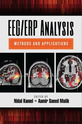 Nidal / Malik |  Eeg/Erp Analysis | Buch |  Sack Fachmedien