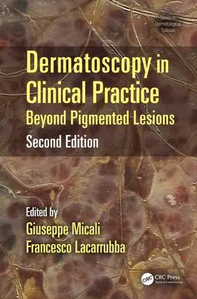 Micali / Lacarrubba |  Dermatoscopy in Clinical Practice | Buch |  Sack Fachmedien