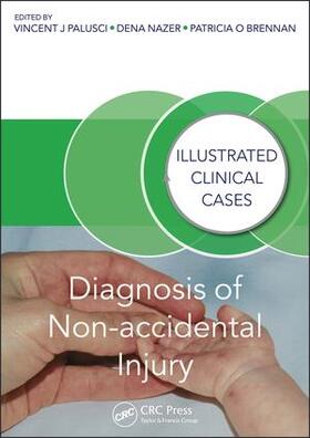 Palusci / Nazer / Brennan |  Diagnosis of Non-Accidental Injury | Buch |  Sack Fachmedien