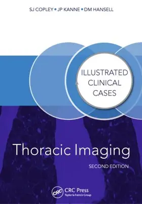 Copley / Hansell / Kanne |  Thoracic Imaging | Buch |  Sack Fachmedien