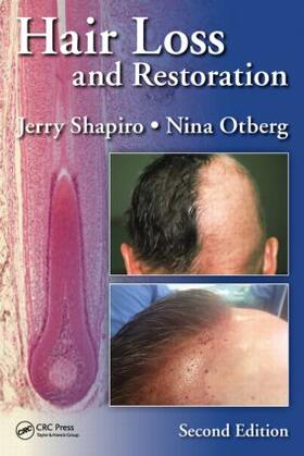 Shapiro / Otberg |  Hair Loss and Restoration | Buch |  Sack Fachmedien