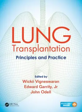 Vigneswaran / Garrity / Odell |  Lung Transplantation | Buch |  Sack Fachmedien