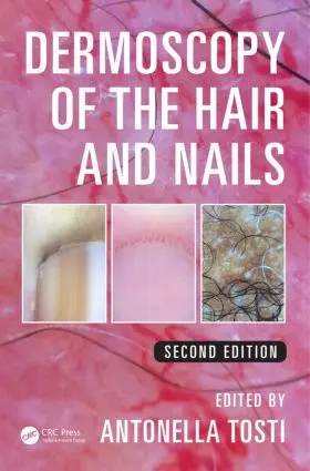 Tosti |  Dermoscopy of the Hair and Nails | Buch |  Sack Fachmedien