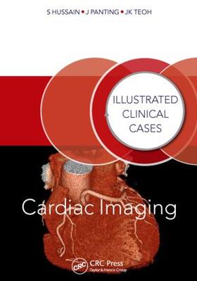 Hussain / Panting / Kiat Teoh |  Cardiac Imaging | Buch |  Sack Fachmedien