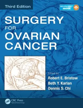 Bristow / Karlan / Chi |  Surgery for Ovarian Cancer | Buch |  Sack Fachmedien