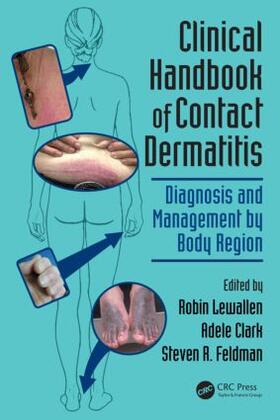 Lewallen / Clark / Feldman |  Clinical Handbook of Contact Dermatitis | Buch |  Sack Fachmedien