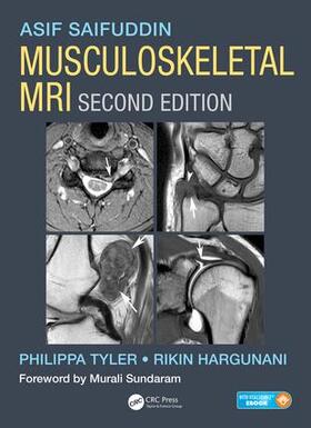 Saifuddin / Tyler / Hargunani |  Musculoskeletal MRI | Buch |  Sack Fachmedien