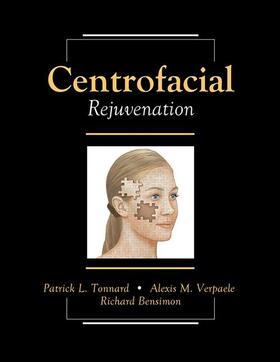 Tonnard / Verpaele / Bensimon |  Centrofacial Rejuvenation | Medienkombination |  Sack Fachmedien