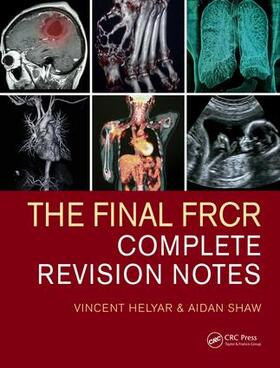 Shaw / Helyar |  The Final FRCR | Buch |  Sack Fachmedien