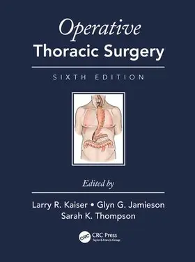 Kaiser / Thompson / Jamieson |  Operative Thoracic Surgery | Buch |  Sack Fachmedien