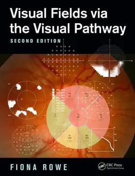 Rowe |  Visual Fields Via the Visual Pathway | Buch |  Sack Fachmedien