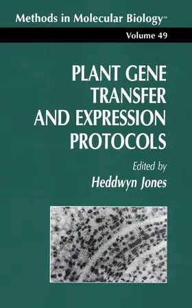 Jones |  Plant Gene Transfer and Expression Protocols | Buch |  Sack Fachmedien