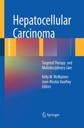 McMasters |  Hepatocellular Carcinoma: | Buch |  Sack Fachmedien