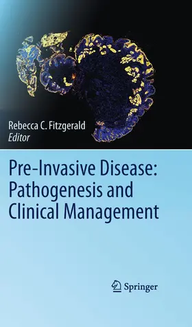 Fitzgerald |  Pre-Invasive Disease: Pathogenesis and Clinical Management | Buch |  Sack Fachmedien