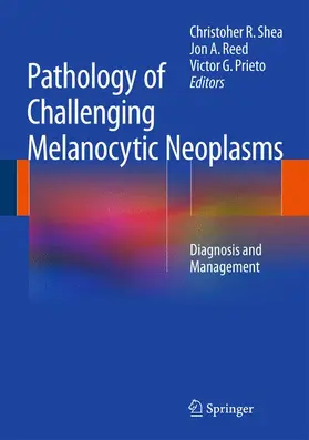 Shea / Prieto / Reed |  Pathology of Challenging Melanocytic Neoplasms | Buch |  Sack Fachmedien