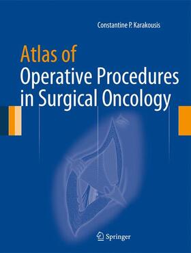 Karakousis |  Atlas of Operative Procedures in Surgical Oncology | Buch |  Sack Fachmedien