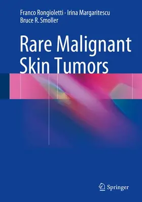 Rongioletti / Smoller / Margaritescu |  Rare Malignant Skin Tumors | Buch |  Sack Fachmedien