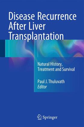 Thuluvath |  Disease Recurrence After Liver Transplantation | Buch |  Sack Fachmedien