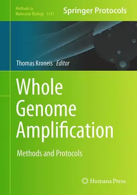 Kroneis |  Whole Genome Amplification | Buch |  Sack Fachmedien