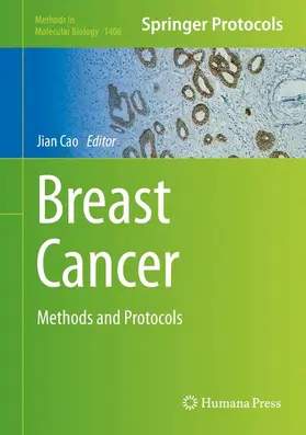 Cao |  Breast Cancer | Buch |  Sack Fachmedien