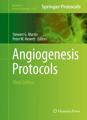 Hewett / Martin |  Angiogenesis Protocols | Buch |  Sack Fachmedien