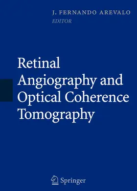 Arévalo |  Retinal Angiography and Optical Coherence Tomography | Buch |  Sack Fachmedien