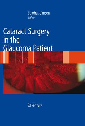 Johnson |  Cataract Surgery in the Glaucoma Patient | Buch |  Sack Fachmedien