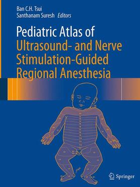 Suresh / Tsui |  Pediatric Atlas of Ultrasound- and Nerve Stimulation-Guided Regional Anesthesia | Buch |  Sack Fachmedien