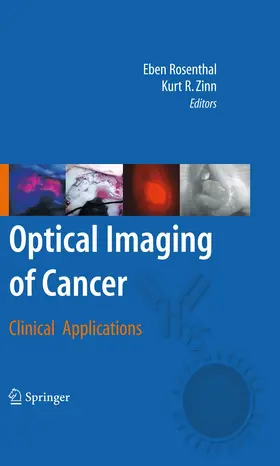 Zinn / Rosenthal |  Optical Imaging of Cancer | Buch |  Sack Fachmedien