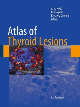 Heilo / Grøholt / Sigstad |  Atlas of Thyroid Lesions | Buch |  Sack Fachmedien