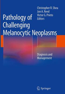 Shea / Prieto / Reed |  Pathology of Challenging Melanocytic Neoplasms | Buch |  Sack Fachmedien