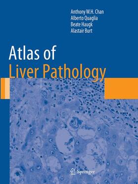 Chan / Burt / Quaglia |  Atlas of Liver Pathology | Buch |  Sack Fachmedien