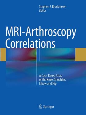 Brockmeier |  MRI-Arthroscopy Correlations | Buch |  Sack Fachmedien